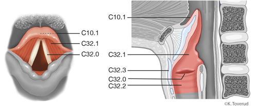 14.12 Larynxcancer 14.12.1 Översikt ICD-10 Främre (linguala) ytan av struplock (epiglottis) C10.