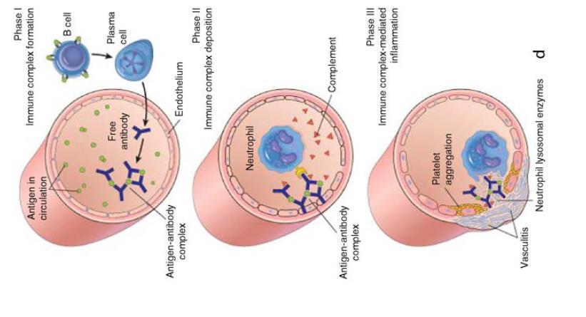 1. B-celler aktiveras av antigen bildas antikroppar och tillsammans med antigen immunkomplex 2.