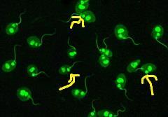 Figur 3: En grön fluorescens i kinetoplasten hos Crithidia luciliae vid en CLIFT-analys (19). ELISA är en antikroppsbaserad metod som kan användas för detektion av anti-dsdna antikroppar.