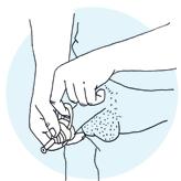 Att applicera urindroppsamlaren När urindroppsamlaren appliceras bör det vara en till två centimeter mellan ollonet och utloppet.