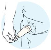 Urindroppsamlare med häftremsa 1.