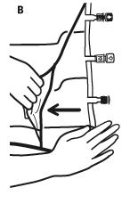 Syreabsorbator 1.