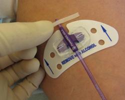 bort med NaCl 9 mg/ml och skall torkas torrt mekaniskt innan desinfektion sker Tvätta mekaniskt instickstället med Klorhexidinsprit 5