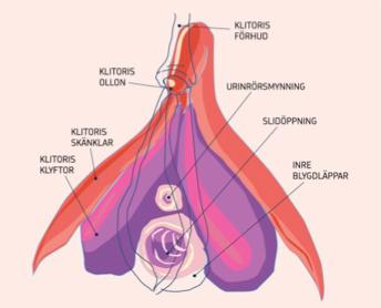 Psykosexuella besvär - Stora delar av den erektila vävnaden finns kvar. - Sexuella dysfunktionen pga vävnadsskador men också andra faktorer.