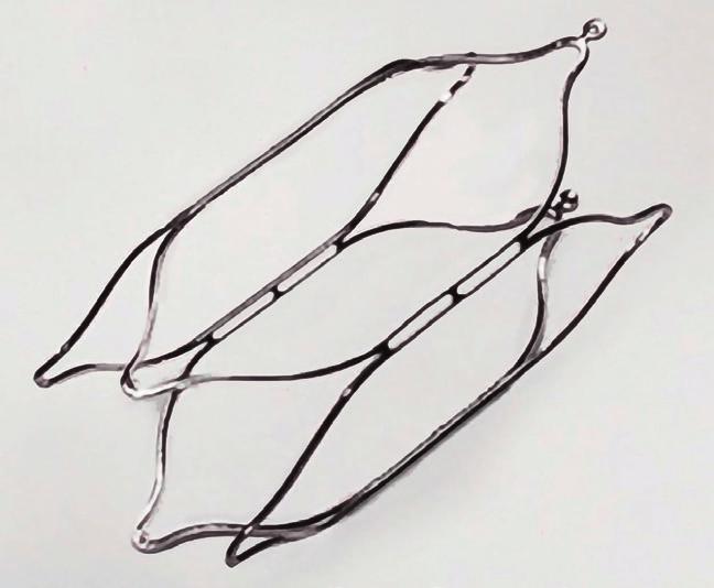 MobiusHD tet används en mekanisk stimulering i form av ett självexpanderande glest nät (se bild) av nitinol, dvs nickel-titan.