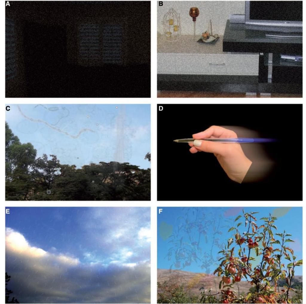 Illustrations done by three patients to demonstrate visual snow (tiny dynamic flickering dots in the entire visual field) in the dark (A),