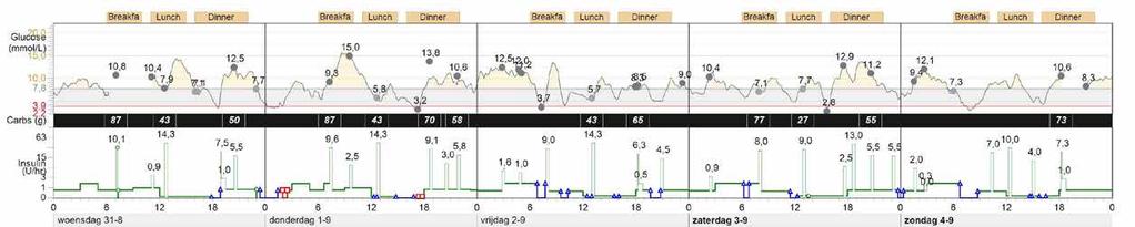 Grafen ger en bra överblick av din glukoskontroll. Insulin (E/t) Titta på när bolusar tagits. Hur blev resultaten? Fanns det BS-värden innan doseringarna?