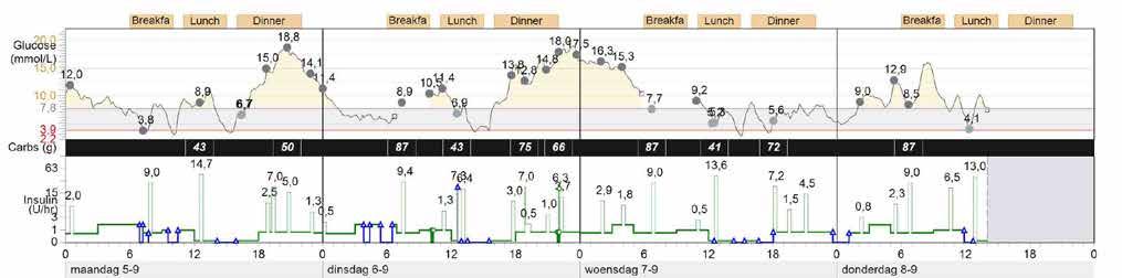. B De kolhydrater du lägger in via Bolus Wizard eller via loggboken ser du på den svarta raden.