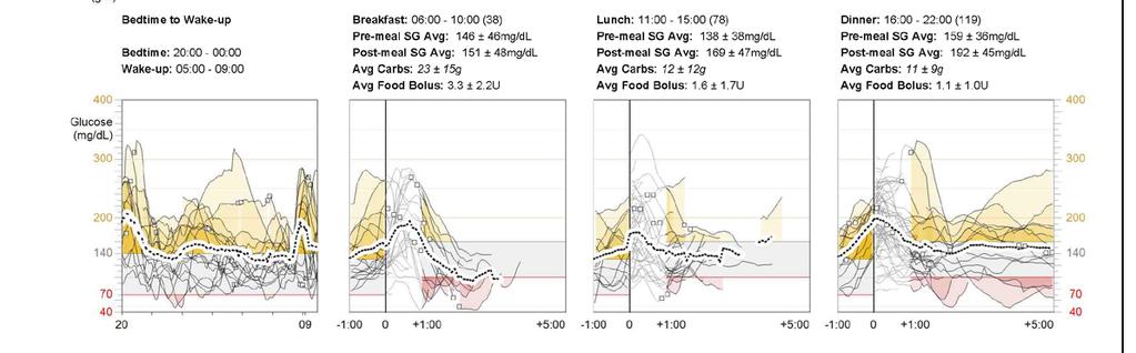 I detta exempel definieras hypoglykemi som värden under mmol/l. De röda områdena i grafen representerar tillfällen då du varit i detta glukosområde.