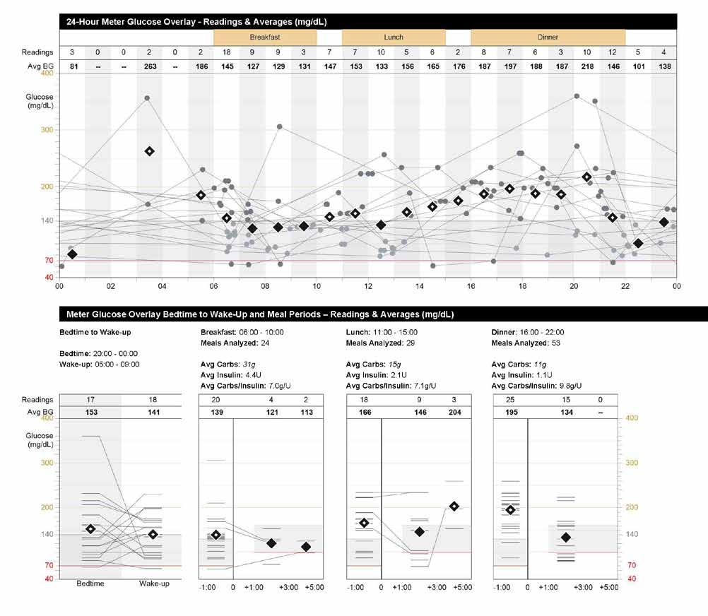 . CARELINK RAPPORTER SENSOR- OCH MÄTARÖVERSIKT ( AV ) Den här rapporten fokuserar på data från blodsockermätaren och kan användas om du har en pump utan CGM.