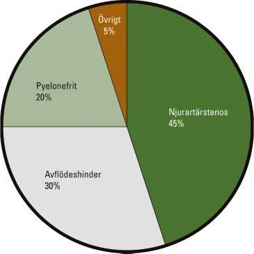 Klinik och vetenskap Figur 1. Indikationer för renografi/njurskintigrafi vid Universitetssjukhuset i Linköping år 2000 (n=401).