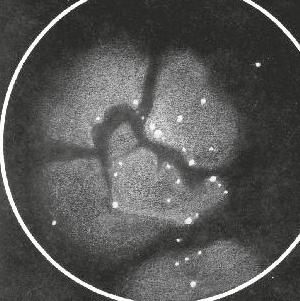 Om du gör rikligt med observationer tränar du ögat och hjärnan att uppmärksamma svaga stjärnor små och detaljer.