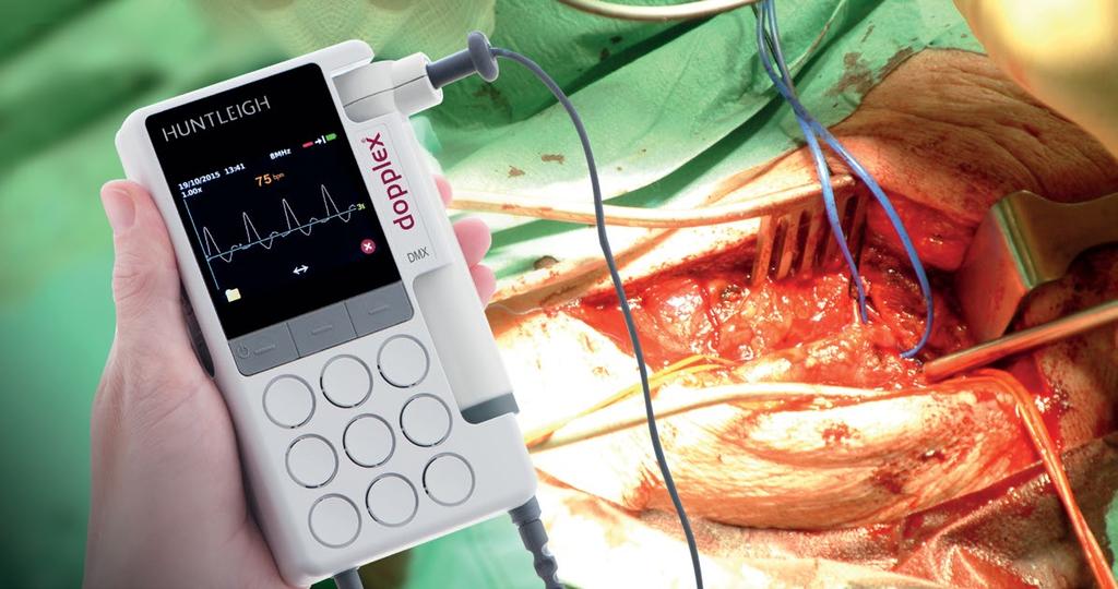 Dokumentation och arkivering Dopplex DR5 Lite är ett unikt programpaket för vaskulär rapportering som används i tillsammans med Dopplex DMX.