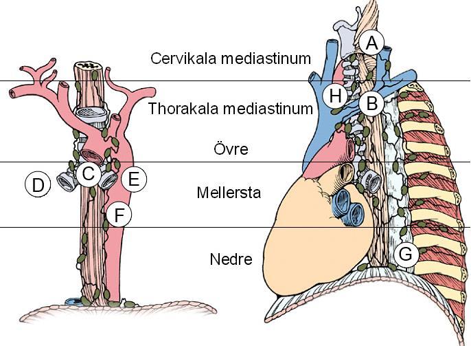 Lymfkörtelstationer hals - thorax [A] Paraesofageala Cervikala [B] Paratrakeala [C] Subcarinala [D] Hö huvudbronk [E] Vä huvudbronk [F] Paraesofageala - mellersta thorakala mediastinum [G]