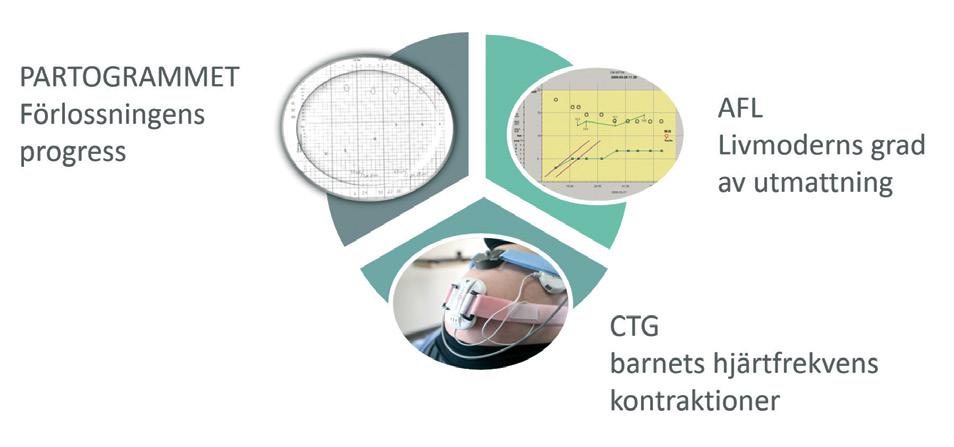 Affärspotential för USA Antal värksvaga förlossningar 800 000 Antal prober per värksvag förlossning 2,5 Intäkt prober i tkr 498 000 Kostnad för prober i tkr 140 000 Täckningsbidrag för prober vid