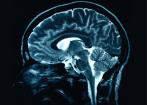 Symtom minst 2 v, stress minst 6 mån B. Brist på psykisk energi el. uthållighet dominerar C.