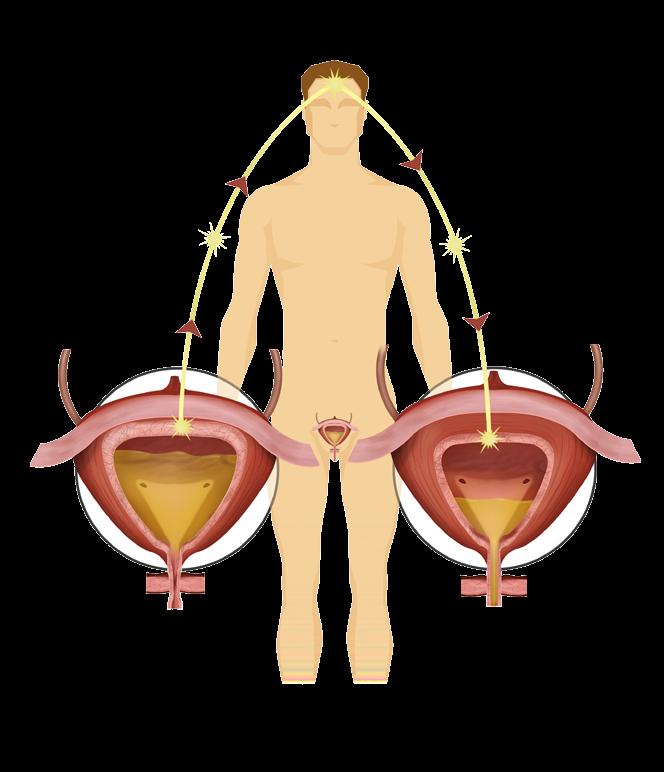 Vad händer i kroppen när du känner dig kissnödig? Urinblåsan är kroppens tillfälliga behållare för urinen. Inuti blåsans vägg finns ett muskellager.