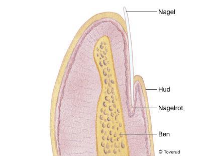 Naglar, hår och körtlar räknas till huden Naglar På fingertopparna och tårna bildas naglar från nagelroten, som ligger i ett veck av överhuden. Cellerna i nagelroten delas, och då växer nageln.