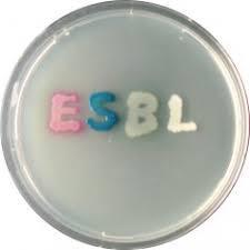 ESBL 5 8 % av E. coli i svenska urin- och blododlingar (mer hos män?