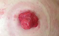 Urinvägarna Vad är en urostomi? Varje gång du äter och dricker, tar kroppen upp de näringsämnen den behöver. Restprodukter rensas bort och lämnar kroppen som urin eller avföring.