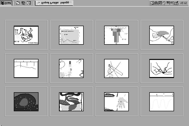 128 Undervisningsbilder Via modul kan man frân diabetesdokumentet nâ undervisningsbilder som kan visas vid behov.