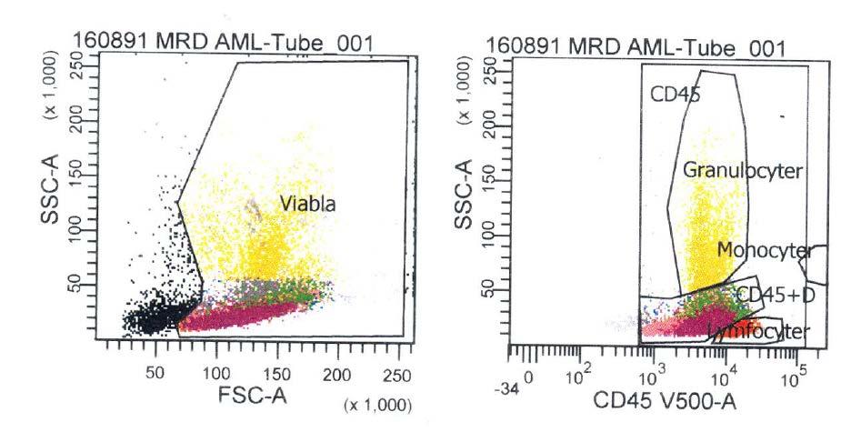 MRD-analys med flödescytometri SSC SSC 1.