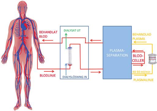 GLYCOSORB-ABO Glycosorb-ABO Företagets huvudprodukt, Glycosorb-ABO, är en medicinteknisk produkt som möjliggör organtransplantationer över blodgruppsgränserna, samtidigt som metoden är skonsam och
