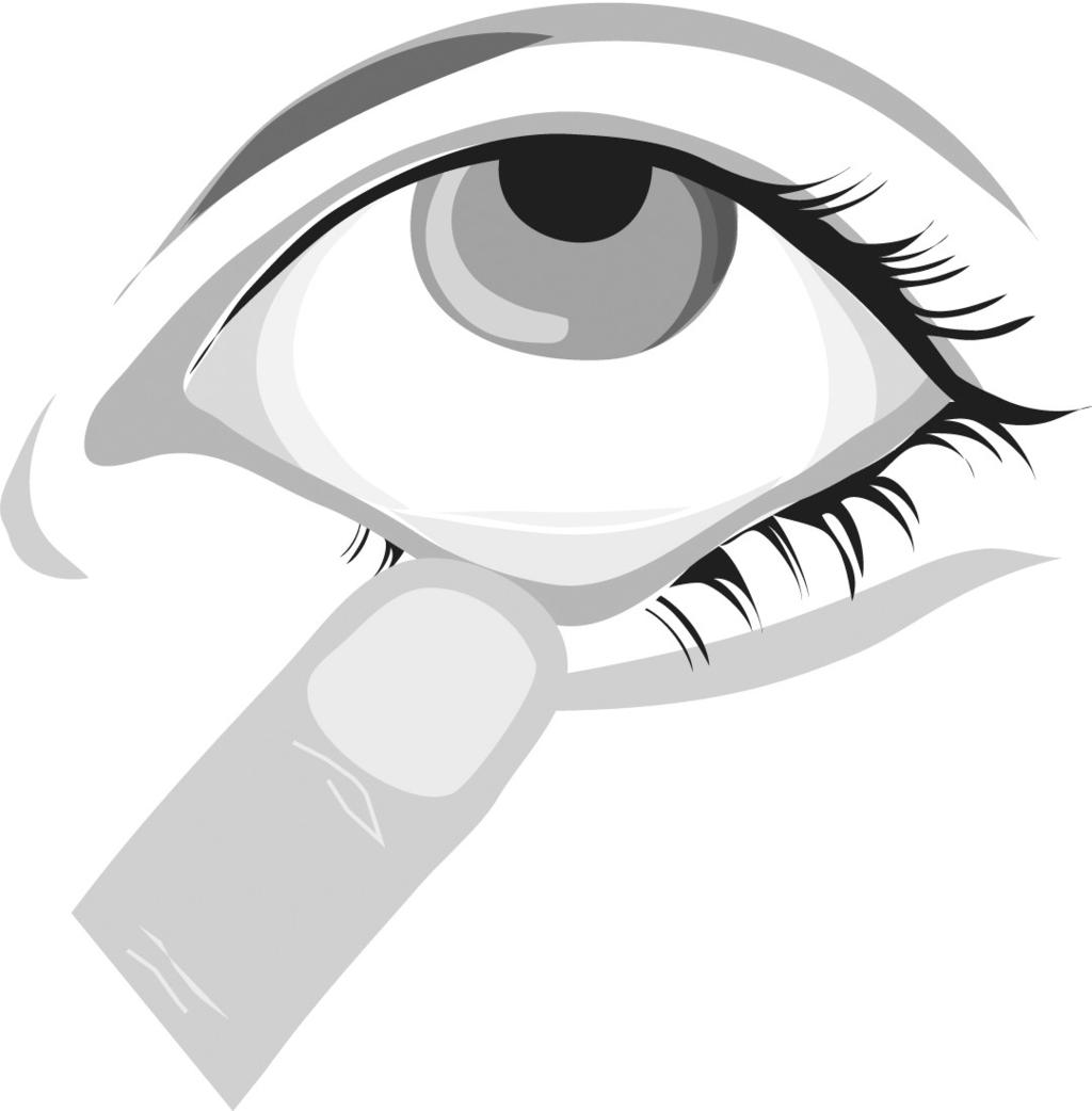 Om du använder mjuka kontaktlinser, ta ut dem innan du använder ögondropparna och vänta sedan minst 15 minuter med att sätta in linserna efter det att Brimonidin