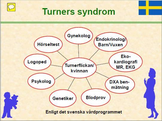 Turners syndrom forts Hypergonadotrop hypogonadism, infertilitet Koarktatio aortae och biskupid
