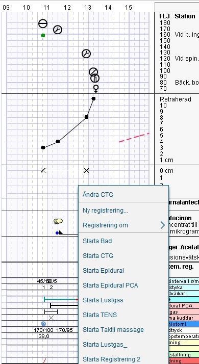 Sidan 9 Nytt namn på högerklicksalternativ vid registreringar i Partogram. Ändra/Stoppa heter nu Ändra. Knappen Ordinationslista i Partogrammet har ersatts med Läkemedel Utdelningsvy.