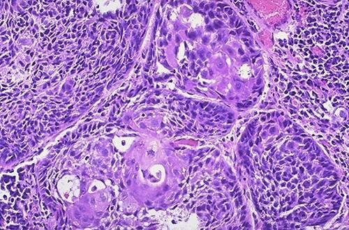 (cytologisk undersökning) -