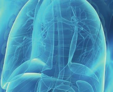I Sverige har nu fler än 1100 patienter behandlats med OPDIVO (nivolumab)1 MALIGNT