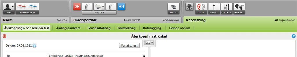 Starta anpassningen 1. Klicka på fliken [Anpassning]. 2.