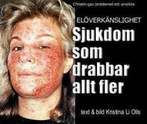 vad bilden visar. Det är inte acceptabelt som mänsklig rättighet. Jag har pratat med Hörselskadades Riksförbund (HRF), de är medvetna av problemet.