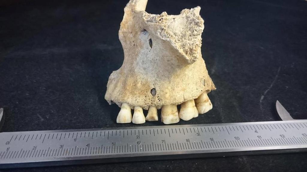 (mandibula) höger (dexter) Molar 1 12 7 9 7 12 Molar 2 7 10 8 10 10 Molar 3 6 5 4 6 6 Premolar1 7 5 10 10 10 Premolar2 4 9 14 11 14 Canin 4 7 5 6