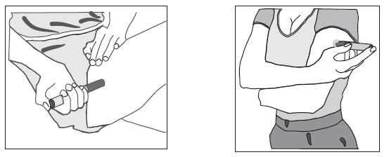 Figur 1