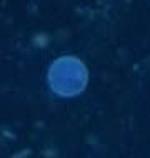Cyclospora 3.