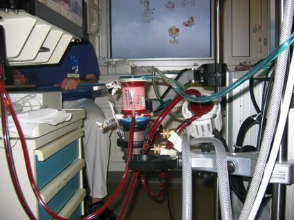 Apparatfunktion Centrifugalpump: CentriMag/Levitronix. CentriMag är en elektroniskt driven centrifugalpump utan lager. En rotor flyter och roterar i ett magnetfält utan mekanisk kontakt.