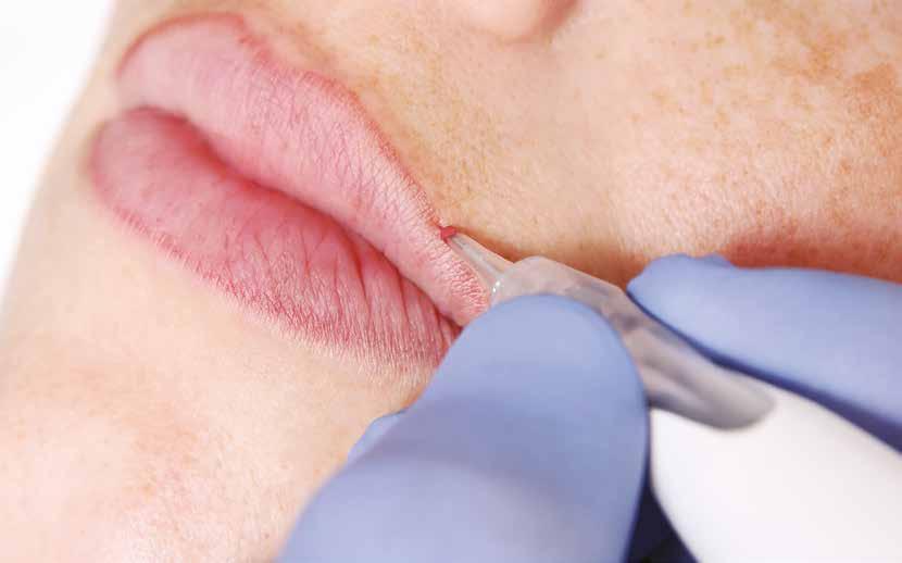 MASTER IN LIP MICROPIGMENTATION Micropigmentering Läppar Dag 1: Teori Dag 2: BaskunskapLipliner KOMPETENSOM- RÅDEN CERTIFICATE Efter att ha lyckats med Micropigmentering Läppar får du ett certifikat