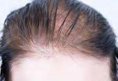 MASTER IN DERMA PIGMENTATION MASTER IN DERMA PIGMENTATION Kosmetisk Bröst & Ärr Pigmentering Skalppigmentering Kosmetisk Bröst &