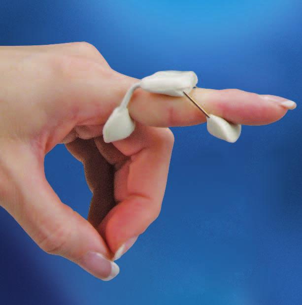 2 Hjälp för Hand & Finger 502 X- Hard Coll-Extensionsfjäder-PIP Denna fingerfjäder ger större hjälp till sträckning och balans åt fingret genom den på båda sidor