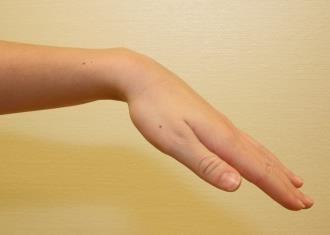 (motstånd i finger och handledsböjare).