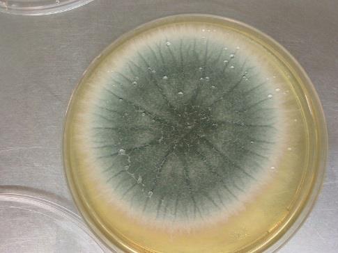 Aspergillus Mögelsvamp. Vanlig i omgivningsmiljön. Inandning av sporer. Kolonisation/Infektion Undvik byggarbetsplatser, komposter, ladugårdar, silos, rota ej i fuktiga och mögliga hus mm.