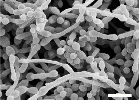 Histoplasma* Pneumocystis