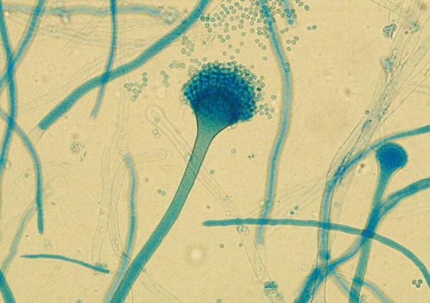 Diagnostik Odlingar Blod Candida, Cryptococcus, andra invasiva jästsvampar, Fusarium 3 odlingar sensitivitet 50 75% för Candida. Tid till positivt fynd.