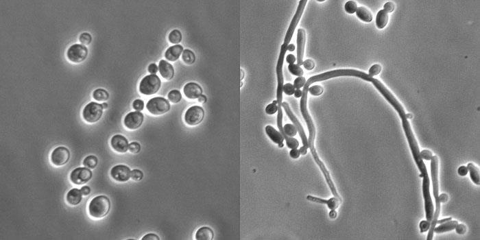 Candida C albicans, C glabrata, C krusei, C tropicalis, C parapsilosis, C guillermondi m fl