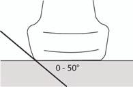 Nålstorlek och vinkel Använd en nål med grovleken 17 till 25 G (rekommenderas). Förbättringar kan bero på typen av nål och märket som används.