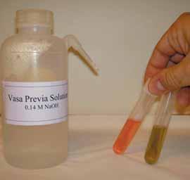 PLACENTA FAKTARUTA Vasa previa test Tag ett rör med färdigpreparerad vasa previa lösning (0,14M NaOH) (se bild 4). Röret proppas och tas med in till den gynekologiska undersökningen.