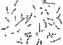 FISH/QF-PCR analyserar numeriska kromosomavvikelser, dvs. trisomi 13, 18, 21 (Downs syndrom) samt könskromosomer. Vid vissa kända strukturella avvikelser (tex. translokationer) kan FISH användas.