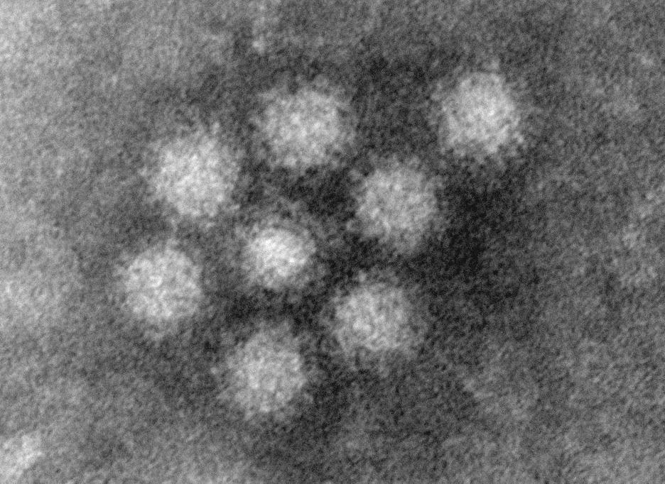 Humant calicivirus Små runda